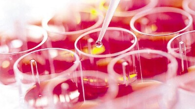 O tedavi artık Türkiye'de!