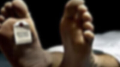 İnsan cesedi neden kokar?