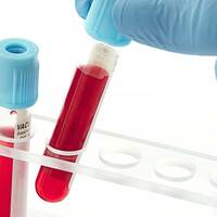 Hangi kan grubu daha şanslı?