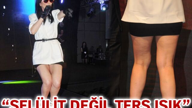 "Selülit değil ters ışık"