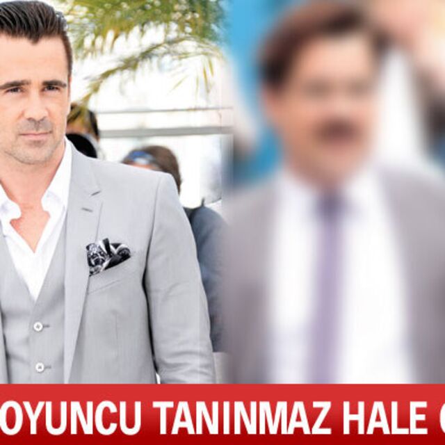 Ünlü oyuncu tanınmaz hale geldi!