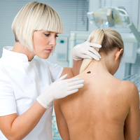 Cilt kanserine uçuk virüsüyle tedavi