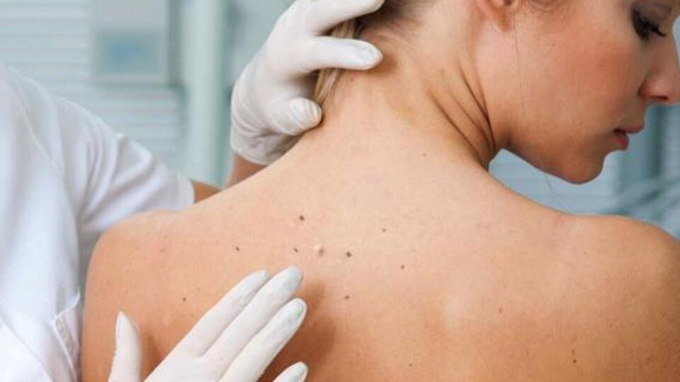 Benlerdeki renk farkına dikkat!