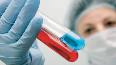 AIDS tedavisiyle ilgili önemli araştırma