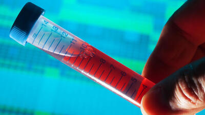 Alzheimer olma riskinizi ele veriyor!