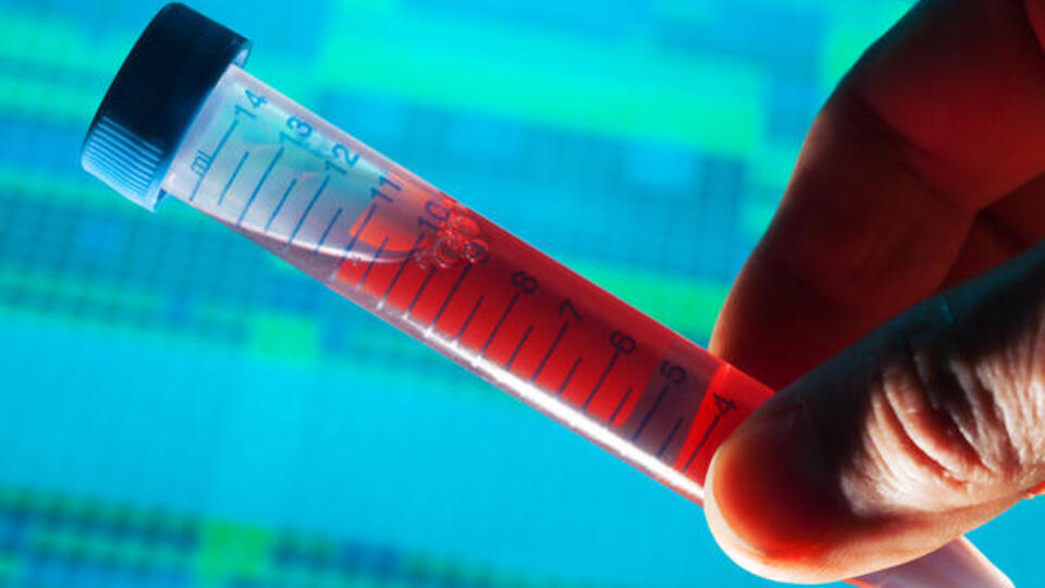 Alzheimer olma riskinizi ele veriyor!