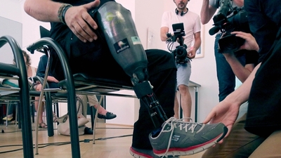 Hissedebilen protez bacak tanıtıldı!