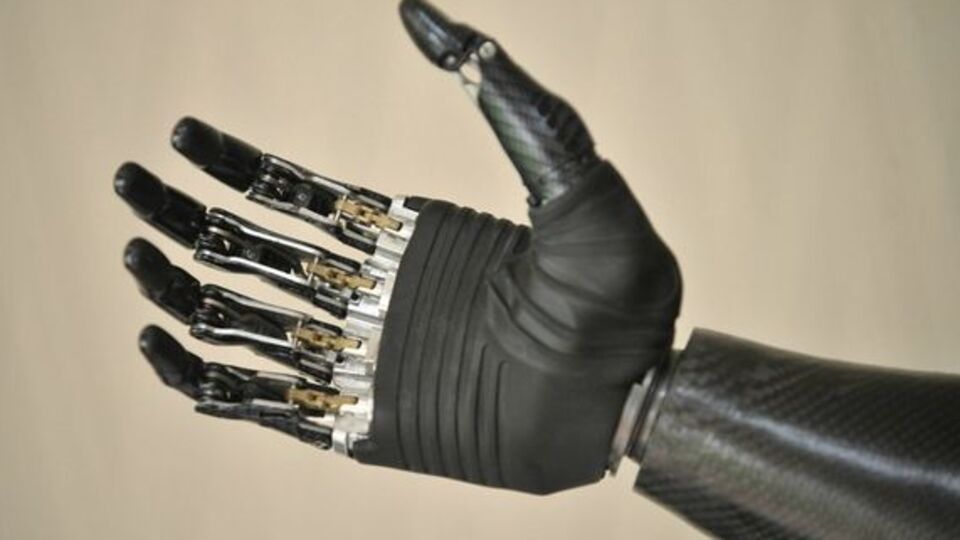 Mucizevi biyonik kol!