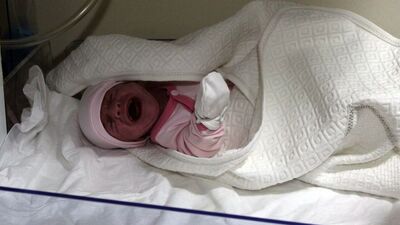 Tüm organları ters doğdu!