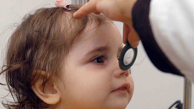 Şaşılık tedavisinde erken teşhis uyarısı