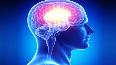 "Beyne ameliyatla espri nakli"