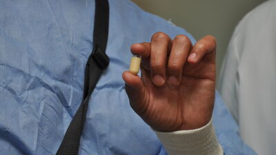 İnce bağırsak hastalıklarına kameralı teşhis