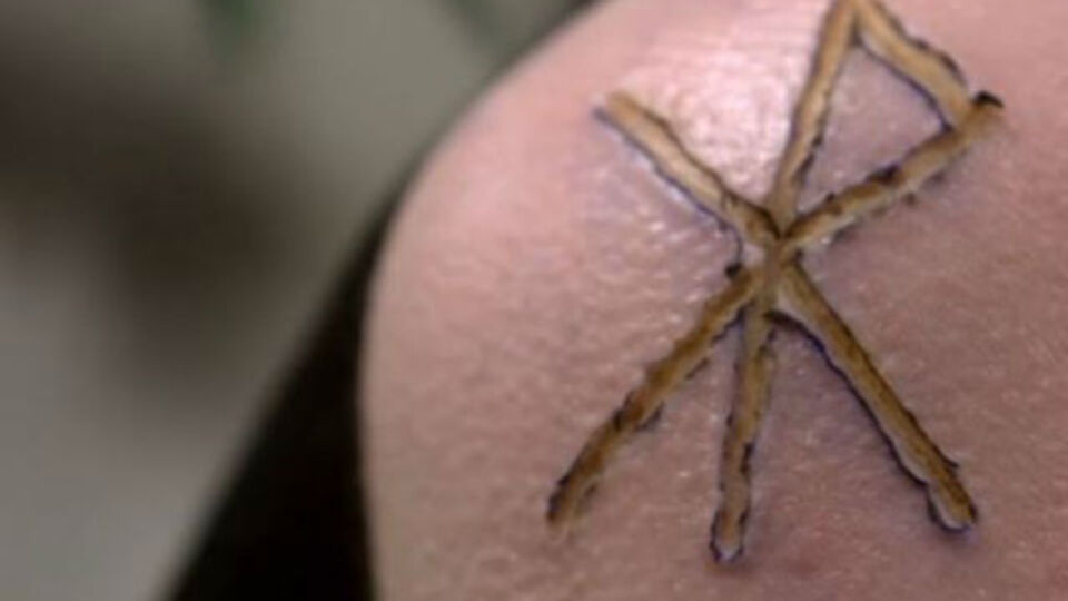 Yeni moda 'dağlama'