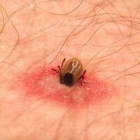 Kene mevsimi başladı!