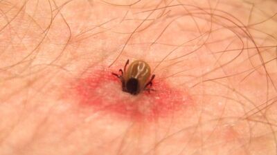 Kene mevsimi başladı!