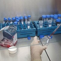 80 yaşındaki hastaya kök hücre nakli