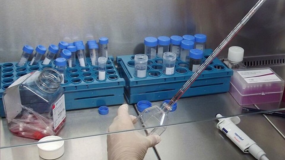 80 yaşındaki hastaya kök hücre nakli