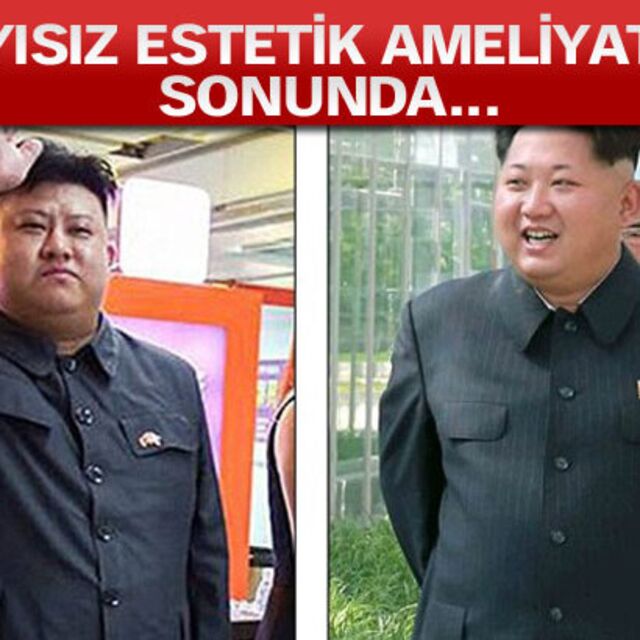 Kim Jong'a benzemek için her şeyi yaptı!