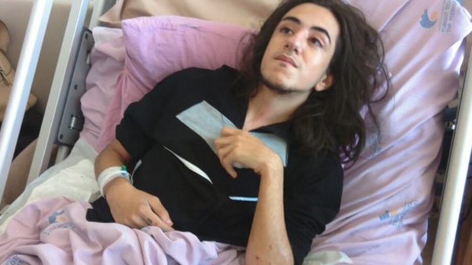 Suruç'taki saldırıdan yaralı kurtulanlar o anları anlattı