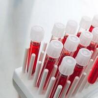 100 hastalığa 1 kan testi