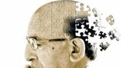 İnsülin direnci Alzheimer'ı tetikleyebilir