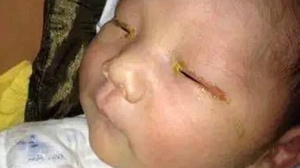 Flaş patlaması bebeği kör etti!