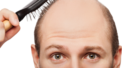 Saç aşısıyla tek seansta kellik tedavisi