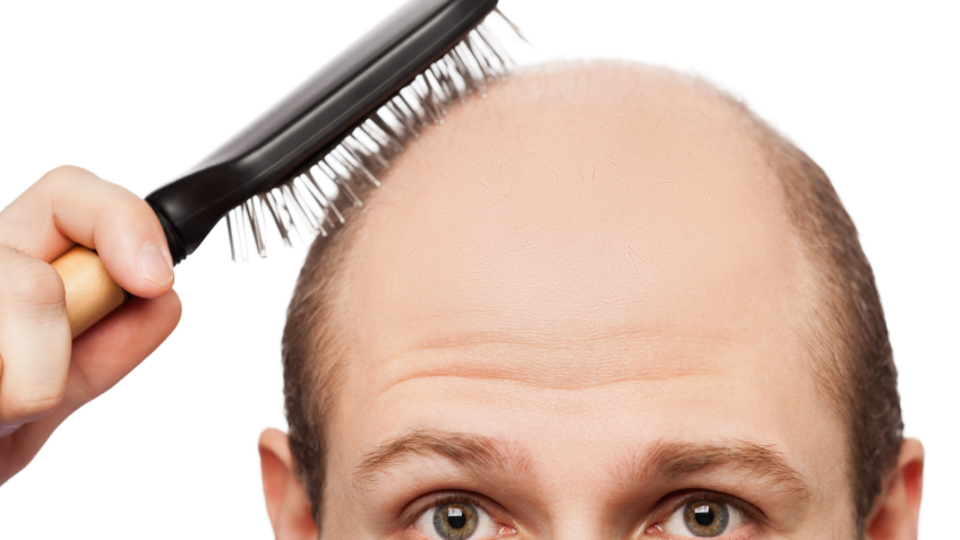 Saç aşısıyla tek seansta kellik tedavisi