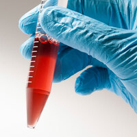 Kordon kanı saklanmalı mı?