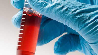 Kordon kanı saklanmalı mı?