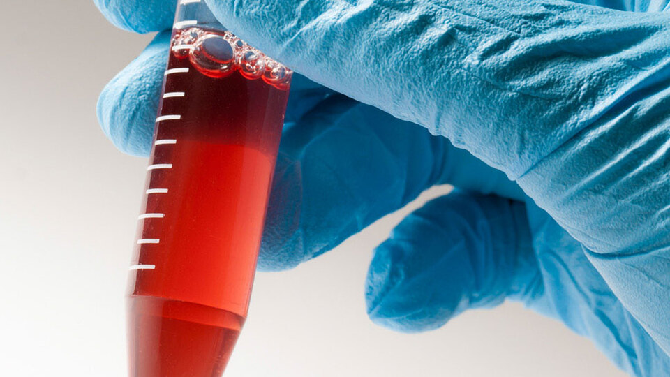 Kordon kanı saklanmalı mı?