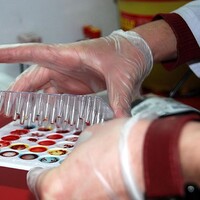 Kök hücre bağısında sevindiren rakakm