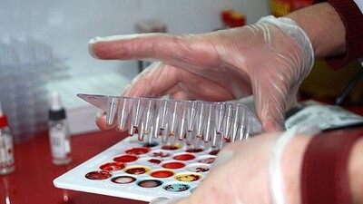 Kök hücre bağısında sevindiren rakakm