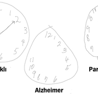 Alzheimer erken teşhisinde akıllı kalem yöntemi!