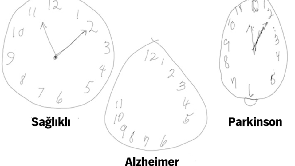 Alzheimer erken teşhisinde akıllı kalem yöntemi!