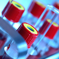 TÜRKÖK dünyaya "umut" olacak