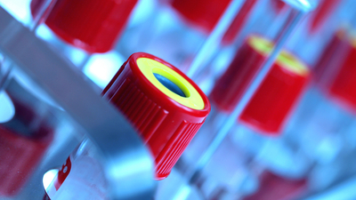 TÜRKÖK dünyaya "umut" olacak