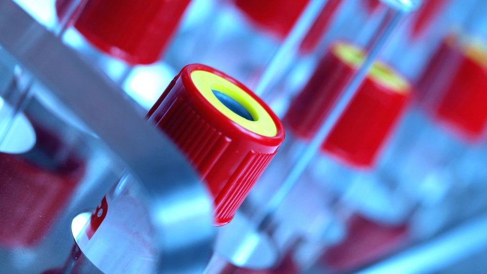 TÜRKÖK dünyaya "umut" olacak