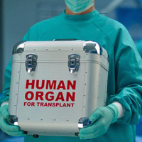 Organ nakli cilt kanserine yol açıyor mu?