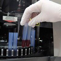 Sinir hasarının tedavisi bulundu