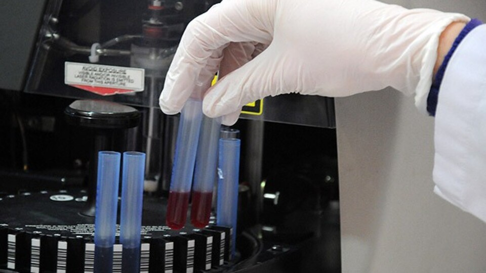 Sinir hasarının tedavisi bulundu