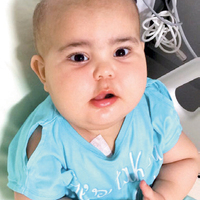 Azra ve Kübra, birer gün arayla ilik nakli olacak