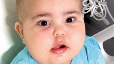 Azra ve Kübra, birer gün arayla ilik nakli olacak