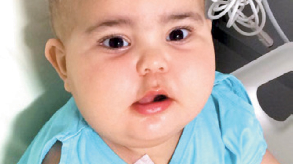 Azra ve Kübra, birer gün arayla ilik nakli olacak