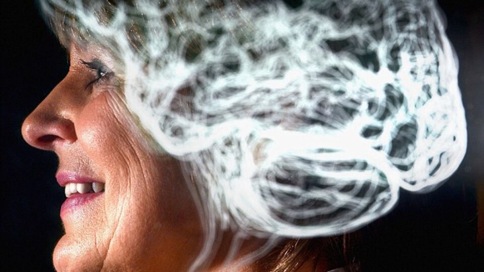 Bu hastalık beyni küçültüyor