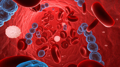 Sepsis (kan zehirlenmesi) yaşamı tehdit ediyor!