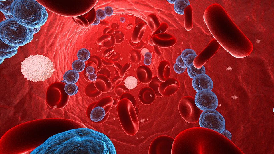 Sepsis (kan zehirlenmesi) yaşamı tehdit ediyor!