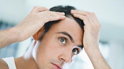 Saçı dökülenler dikkat!