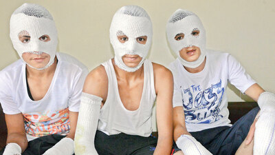 Torpido gözündeki çakmak gazı patladı