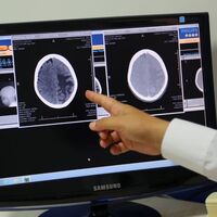 Baş ağrısı diye gitti, tümör çıktı